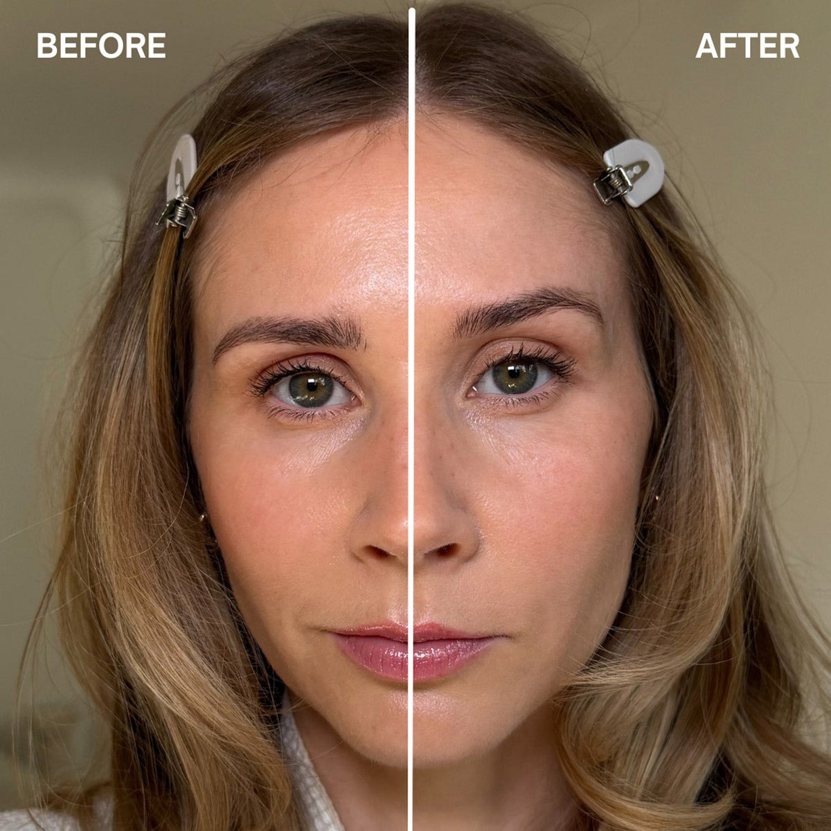 FaceFixers EyeLifting in a Tube-5