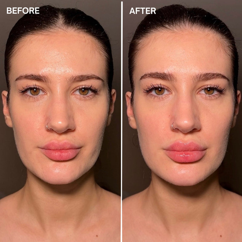 FaceFixers LipVolume Original-5