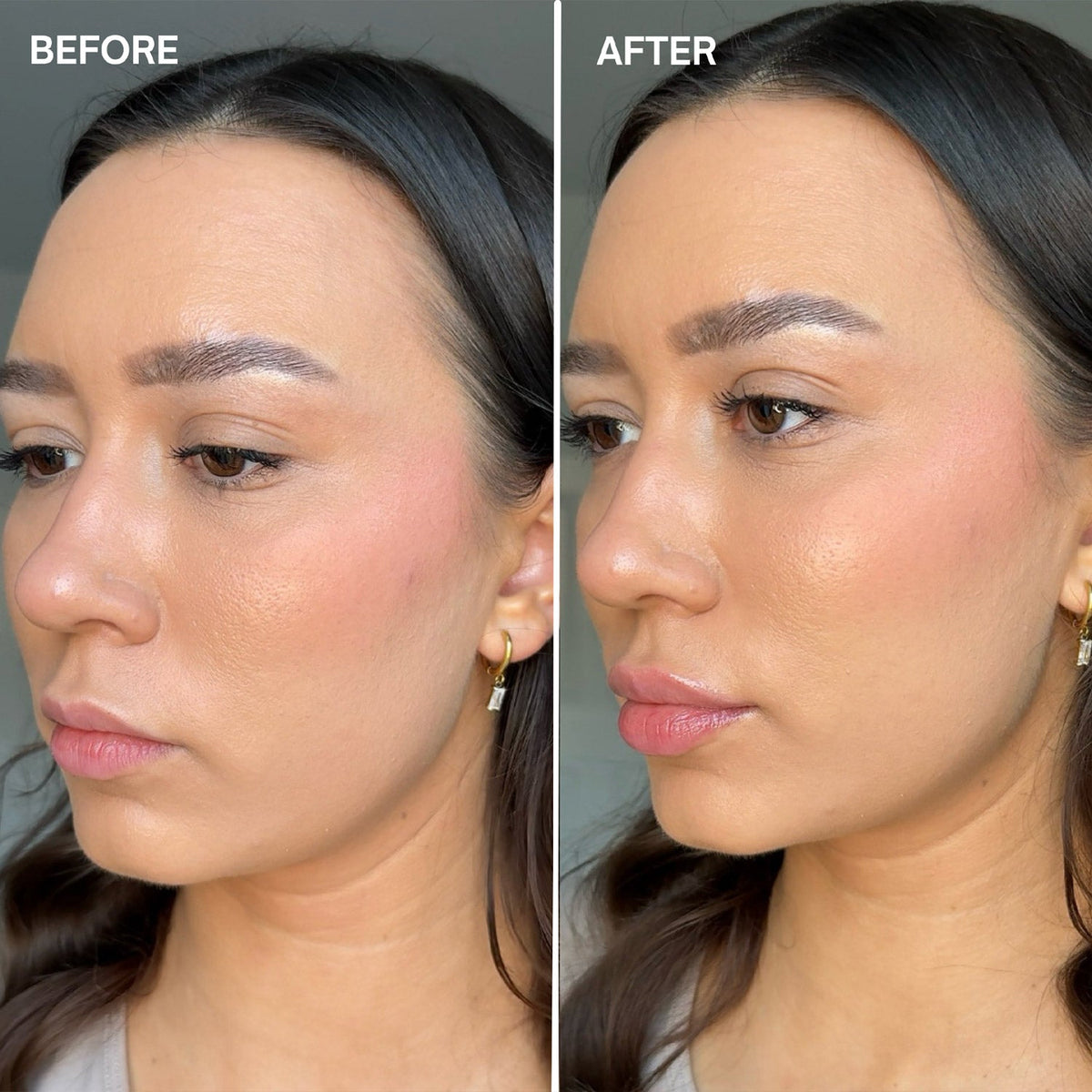 FaceFixers Voluptuous Lipvolume-4