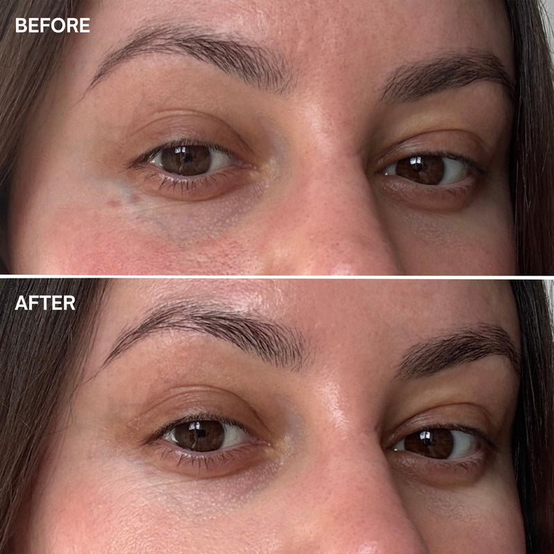 Marine Miracle Eyezone-5