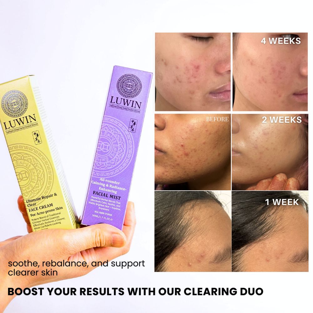 Ultimate Repair & Clear Face Cream for Acne-Prone Skin-11