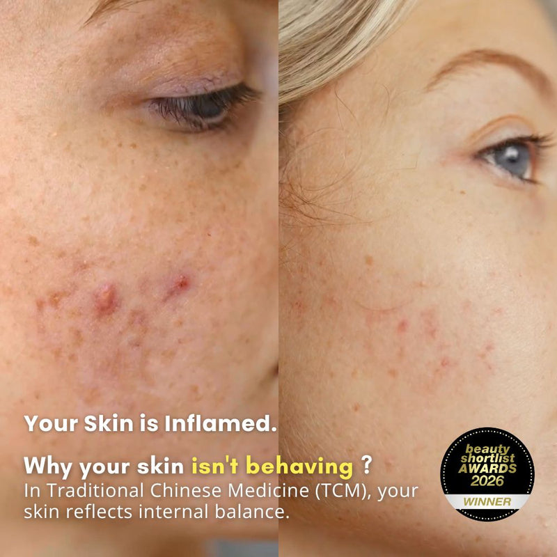 Ultimate Repair & Clear Face Cream for Acne-Prone Skin-3