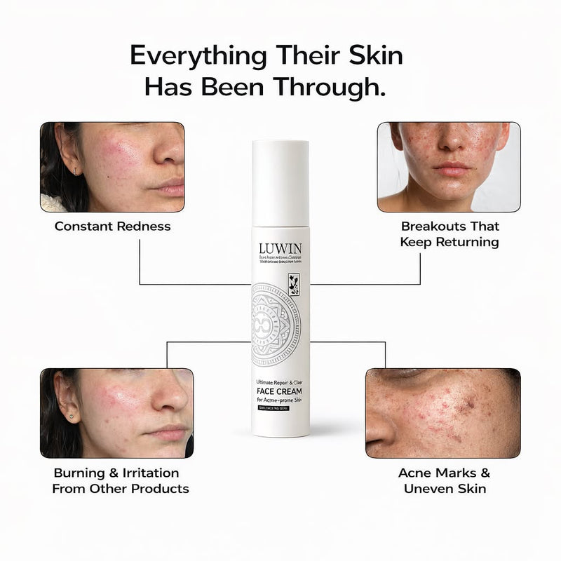 Ultimate Repair & Clear Face Cream for Acne-Prone Skin-14