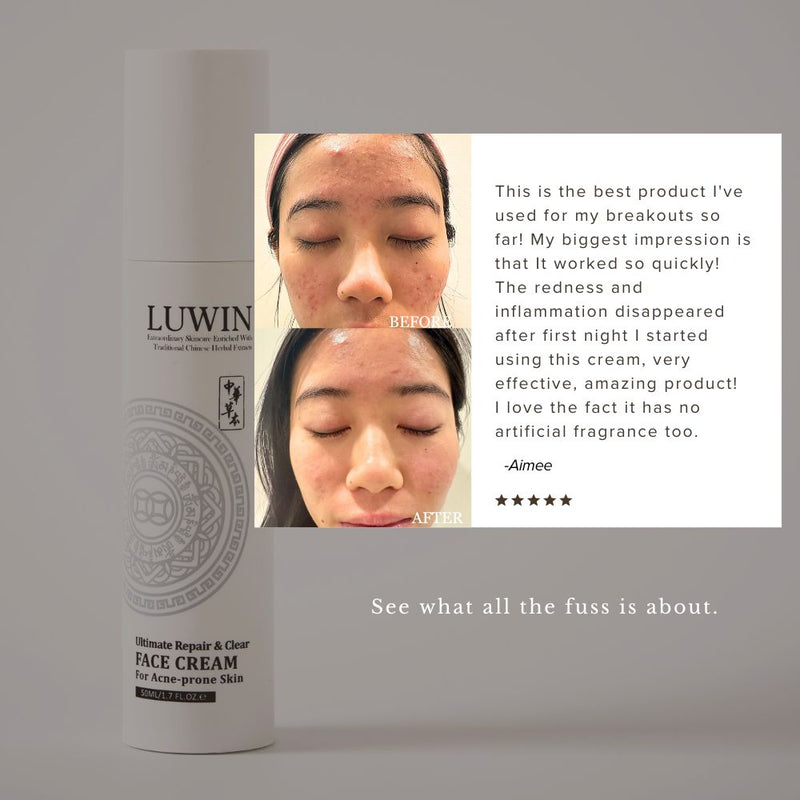 Ultimate Repair & Clear Face Cream for Acne-Prone Skin-9